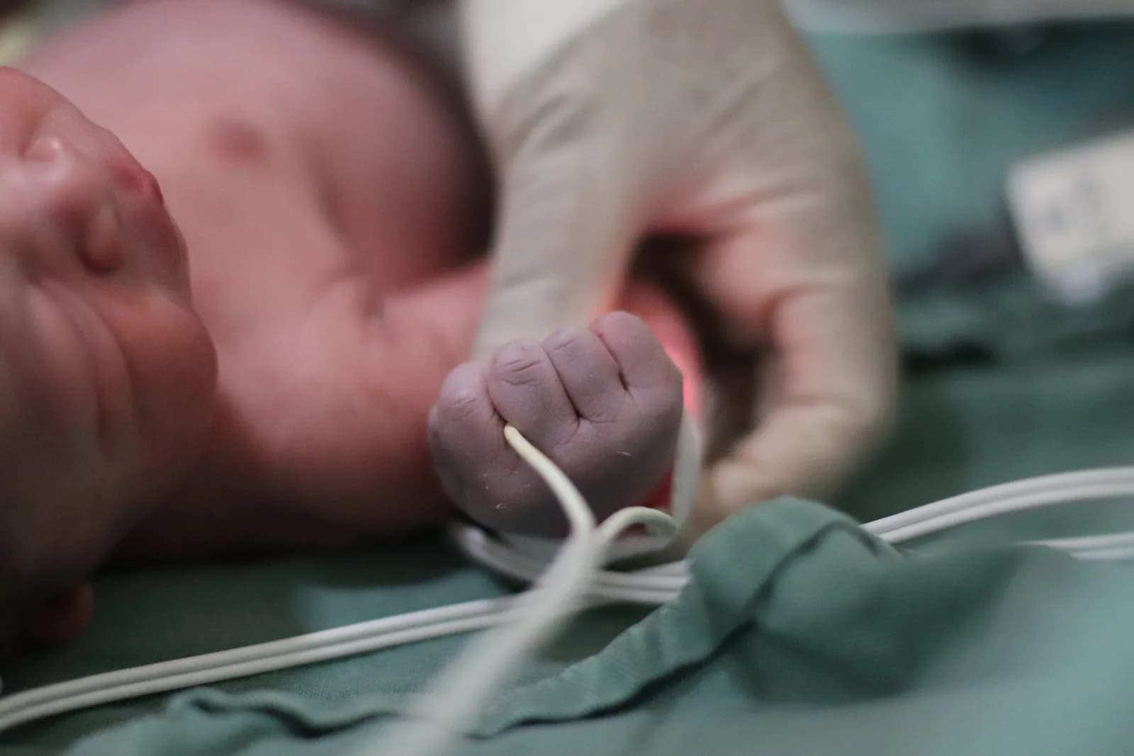 Infecções respiratórias graves em crianças